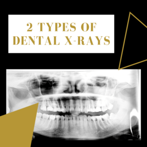 2 Types of Dental X Rays