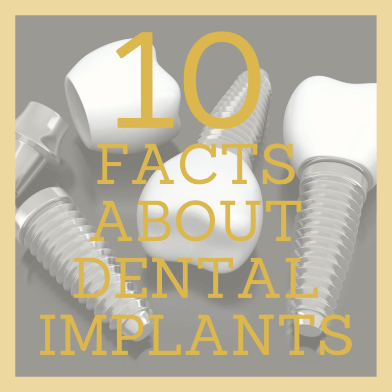 facts dental implants
