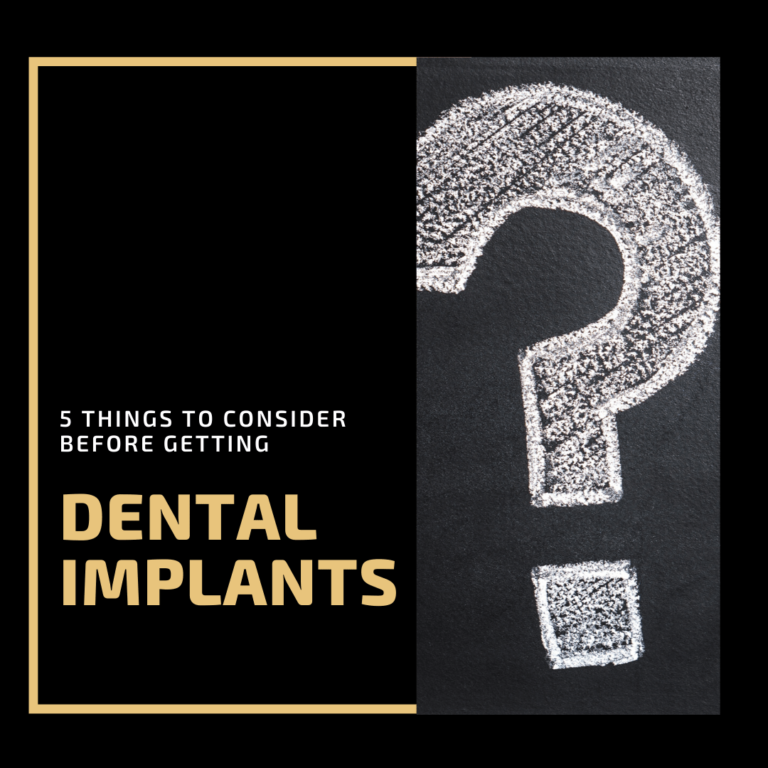 5 Things to Consider Before Getting Dental Implants