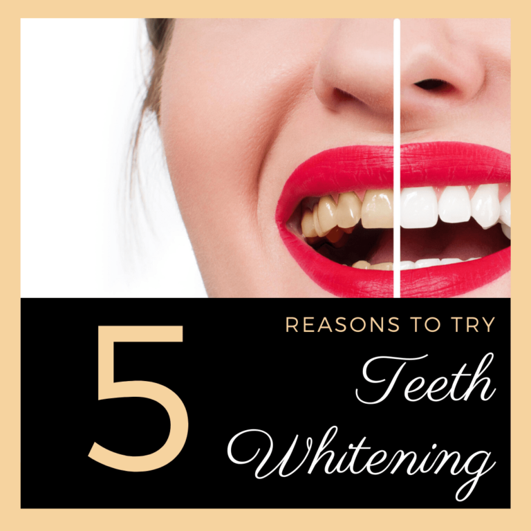 5 Reasons to Try Teeth Whitening
