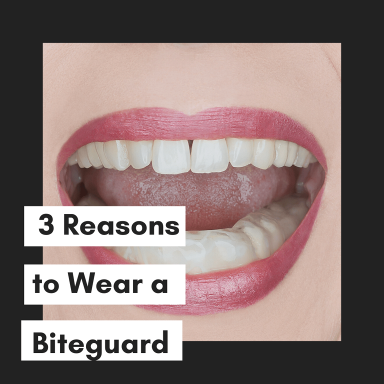 3 Reasons to Wear a Bite Guard