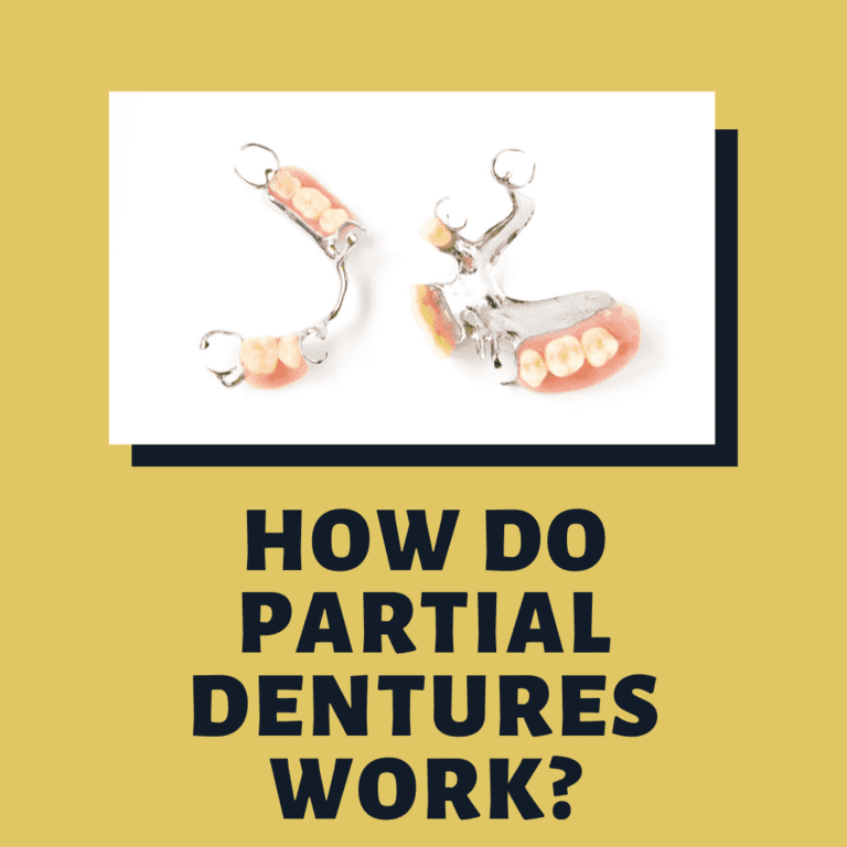How Do Partial Dentures Work?