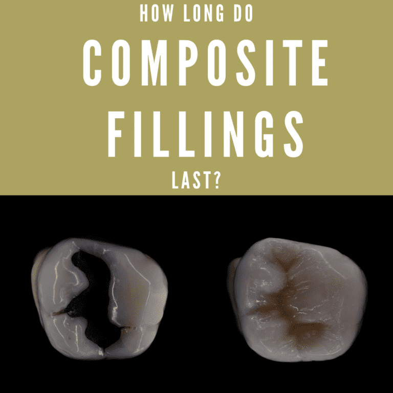 How Long Do Composite Fillings Last
