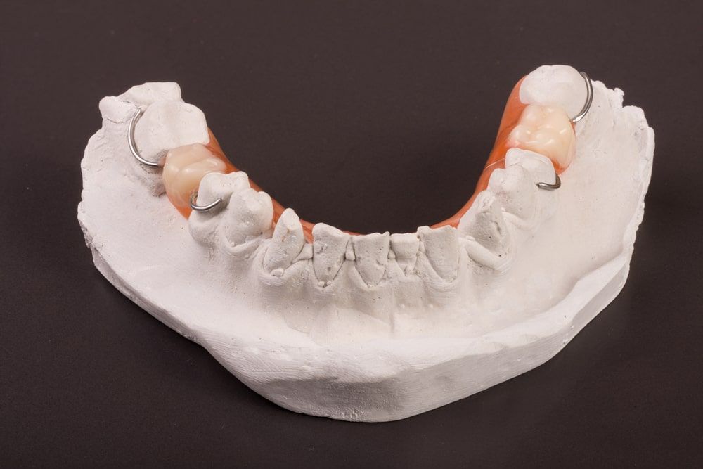 Partial denture over a mouth model