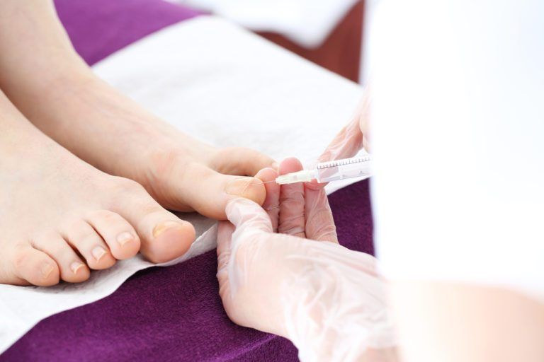 Can an Ingrown Toenail Heal on Its Own?: Family Foot and Ankle