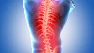 X-ray of back indicating pain
