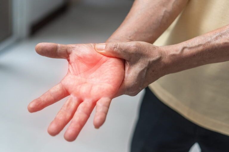 Peripheral Neuropathy pain, Guillain-Barre Syndrome GBS in elderly aged old patient on hand,