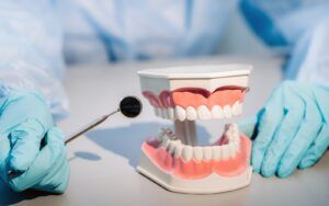 Tooth Model