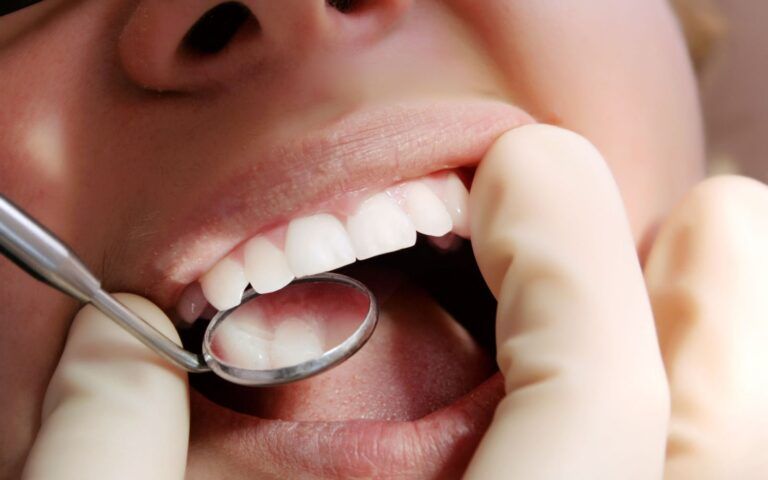 Oral Checkup with Patient Mouth Closeup