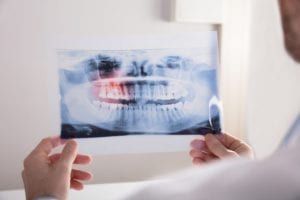 Dental x-ray