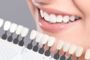 Teeth whitening shade guide being used to match the color of teeth