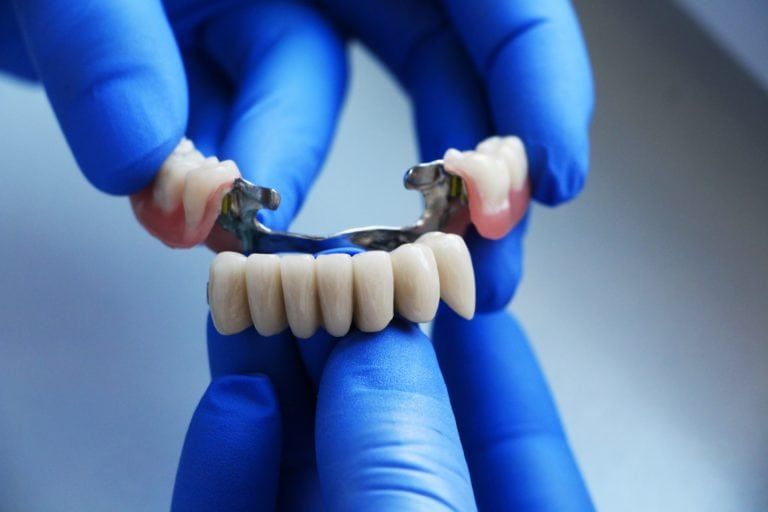 Hands holding a dental bridge