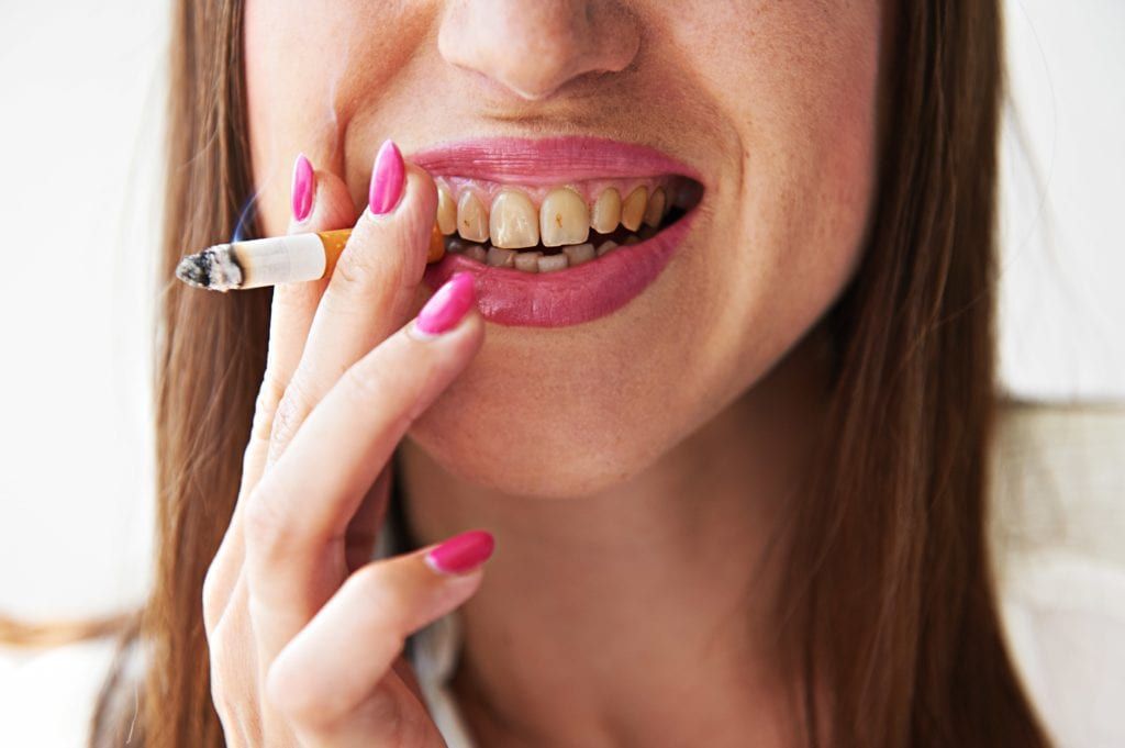 Close up of a woman smoking with stained teeth