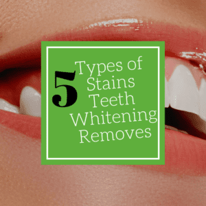 Title banner for "5 types of stains teeth whitening removes"
