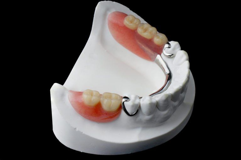 Partial Dentures » Georgetown Dentist | Diana Dental