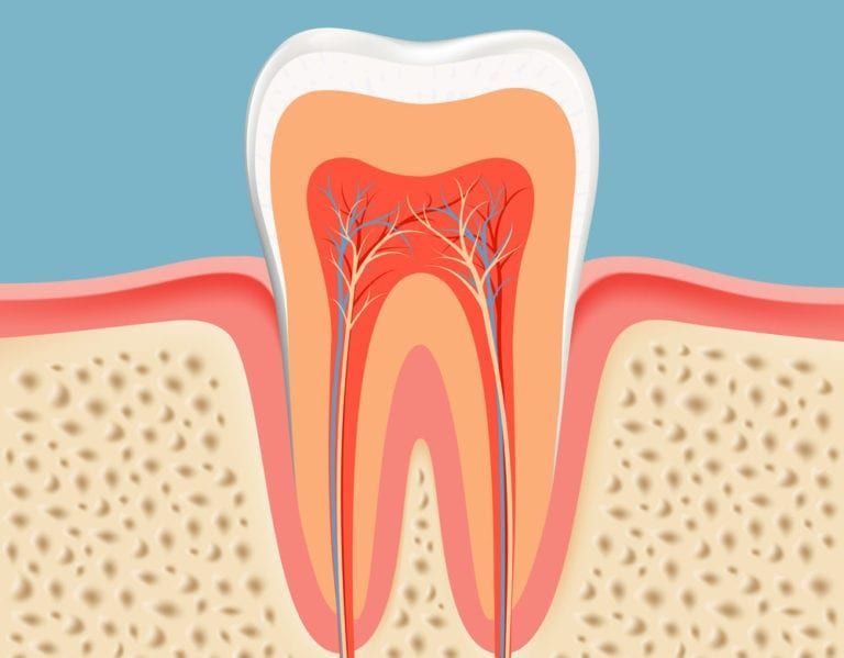 Diagram of a Root Canal