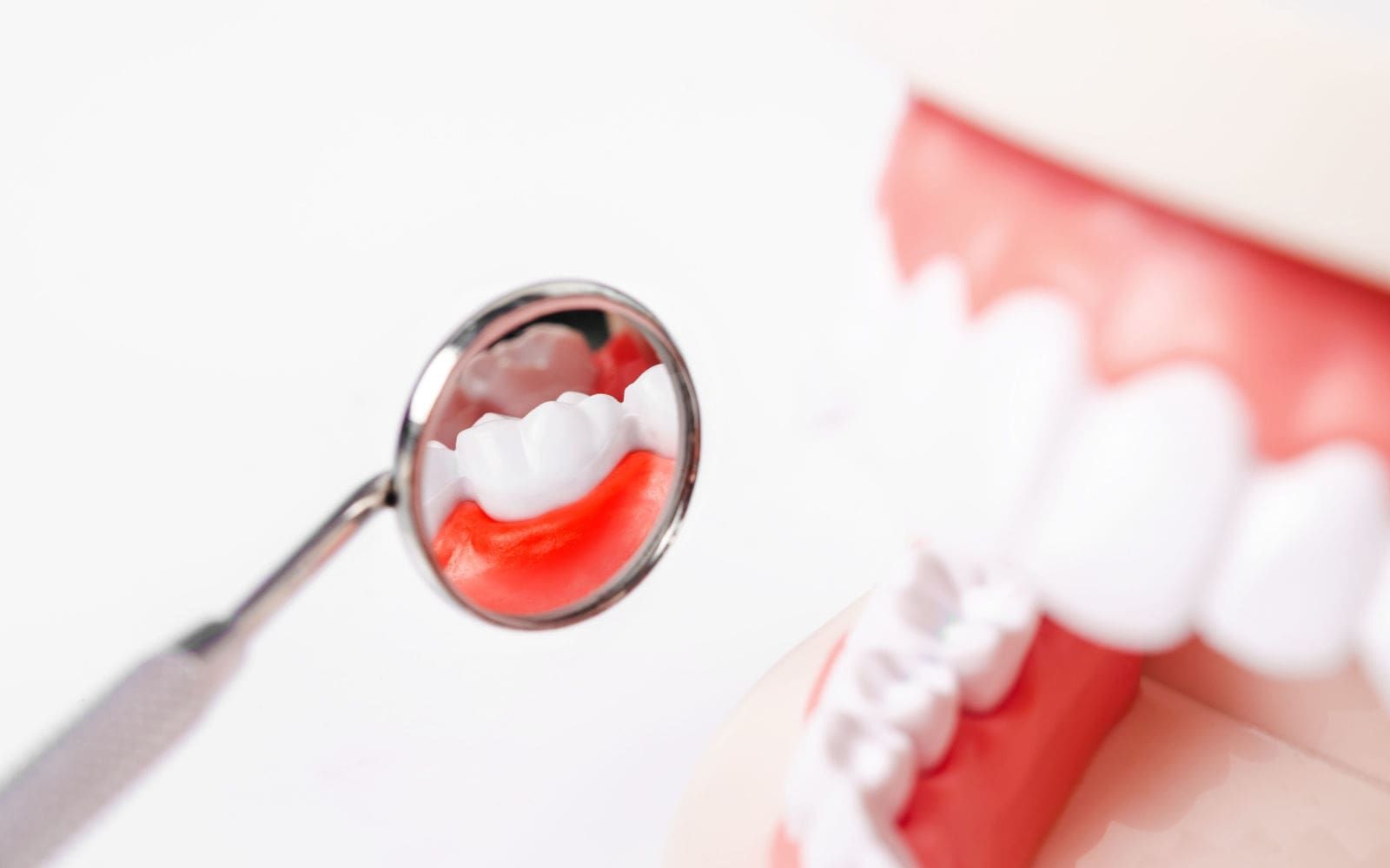 Tooth And Gum Scraping Negative Stain