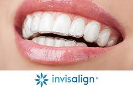 Tips for Invisalign Braces, King Ritson Dental