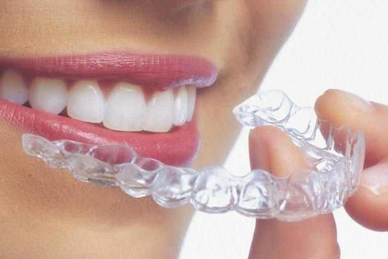 Invisalign®