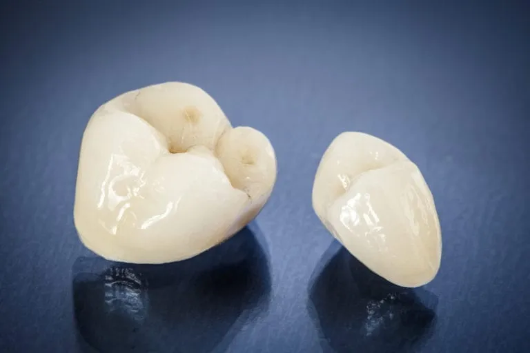 Provisional Restorations