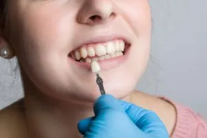 Close up of dentist hand matching tooth shade to a veneer sample