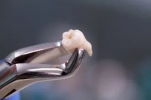 Dental instrument holding and extracted wisdom tooth