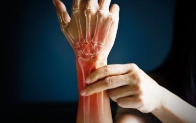What does it mean to have a flare when you have rheumatoid arthritis?