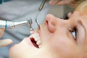 medical dentist procedure of teeth polishing