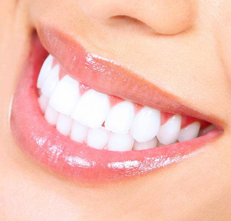 Woman smiling with white Teeth