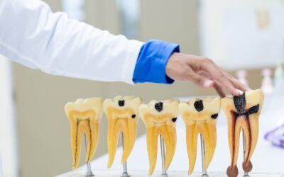 The Causes of Root Resorption and its Endodontic Remedies