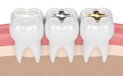 The Benefits of Restorative Treatment Before Orthodontics
