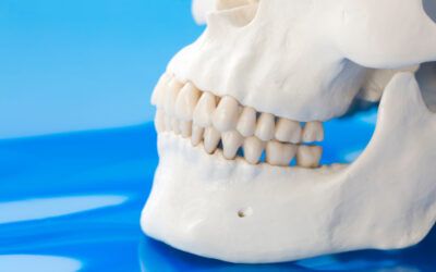 Can Osteoporosis Cause Issues For Dental Implants?