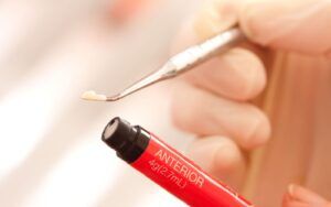 Anterior Composite Resin Treatment