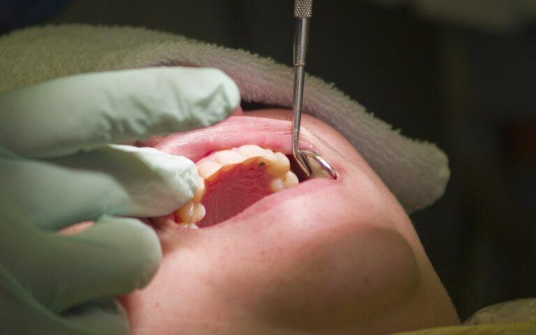 Person Recieving Surgical Endodontic Treatment