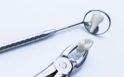 Decoding Wisdom Teeth Removal: Timing and Rationale