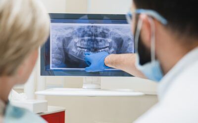 Dental Implant Aftercare and Long-Term Maintenance