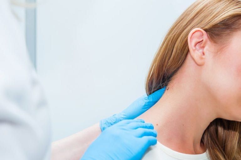 Doctor dermatologist examines birthmark of patient close up. Checking benign moles